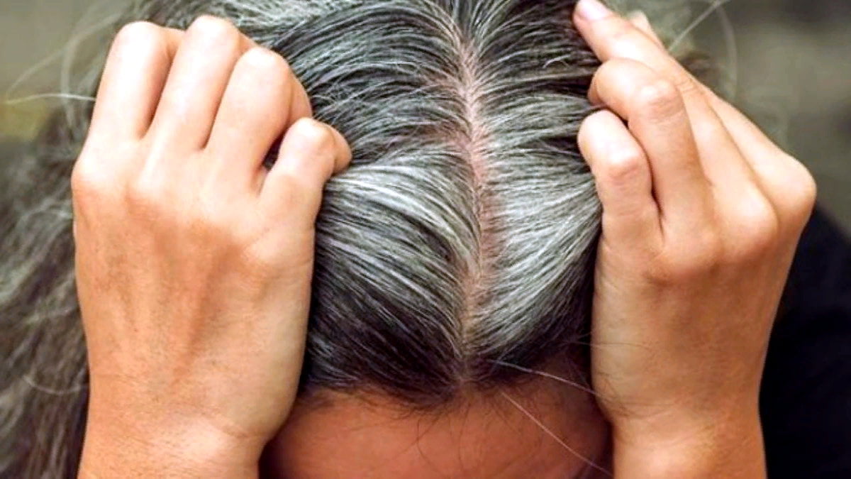 Stresin Saç Beyazlamasına Sebep Olduğu Doğrulandı: Geri Döndürülebiliyor