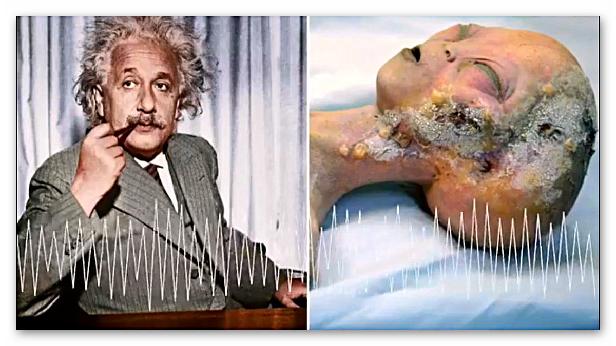 Einstein’ın Asistanından “Acaba” Dedirten İddia: Einstein 5 Uzaylı Cesedi İncelemiş